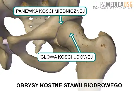 Elementy kostne stawu biodrowego Obrysy kostne - głowa kości udowej, panewka biodra