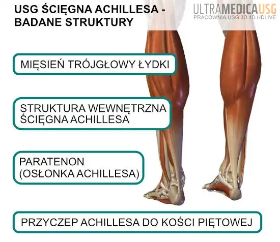 USG ścięgna Achillesa - badane struktury USG ścięgna Achillesa - co bada lekarz ortopeda?