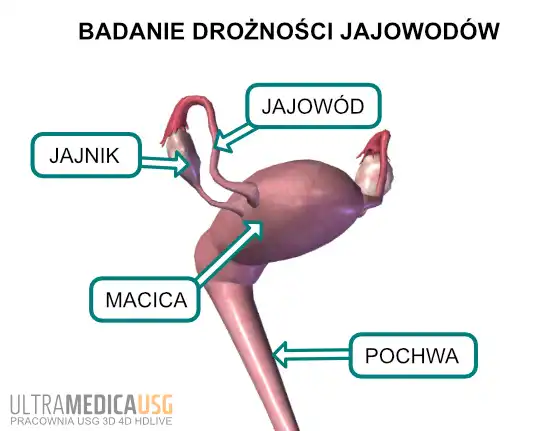 Położenie jajowodów w obrębie narządu rodnego Badanie drożności jajowodów Kraków - położenie jajowodów w obrębie narządu rodnego
