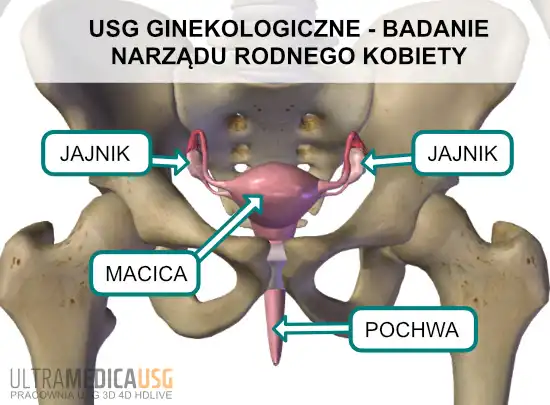 Macica i jajniki badane w USG ginekologicznym USG ginekologiczne Kraków - badane jajniki i macica