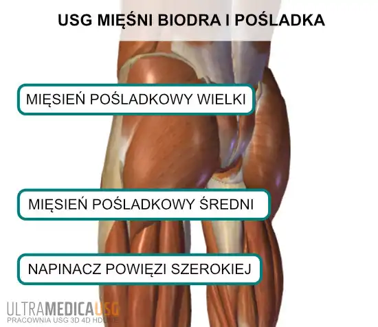 Mięśnie okolicy pośladka Mięśnie okolicy pośladka oceniane w badaniu USG