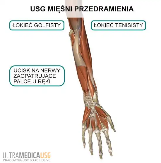 Mięśnie przedramienia - najczęstsze cele badania USG Mięśnie przedramienia - najczęstsze cele badania USG
