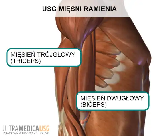 USG mięśni przedramienia USG bicepsa, USG tricepsa Kraków