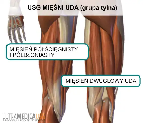 Mięśnie uda grupy tylnej Badanie ultrasonograficzne mięśnia dwugłowego uda