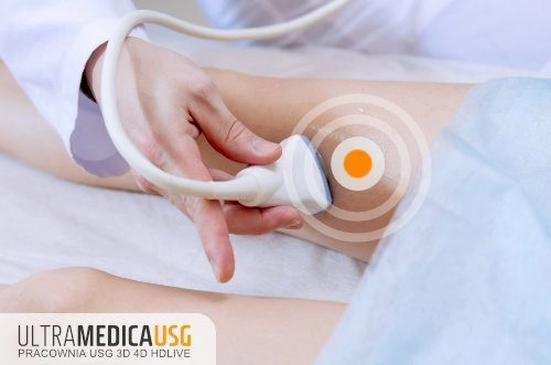 USG doppler tętnic USG tętnic