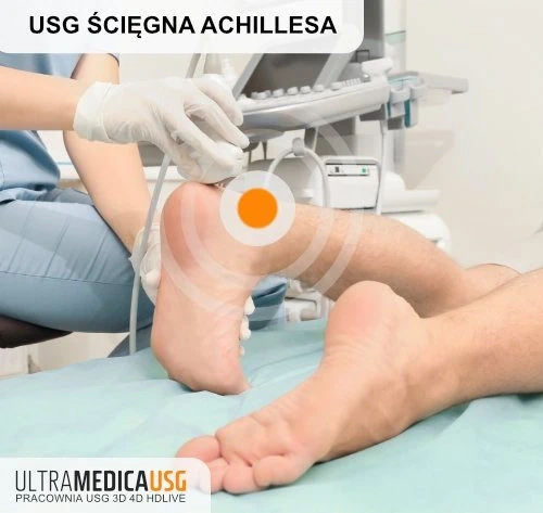 USG Achillesa - głowica aparatu USG przyłożona do stopy USG Achillesa - głowica aparatu USG przyłożona do stopy